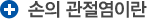 손의 관절염이란