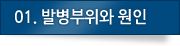 01.발병부위와 원인