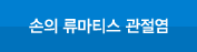손의류마티스관절염