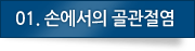 01.손에서의 골관절염