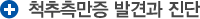 척추 측만증