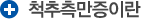 척추 측만증