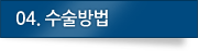 04.수술방법