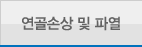 연골손상