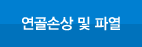 연골손상 및 파열