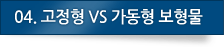 04.고정형vs가동형 보형물