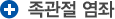 족관절 염좌