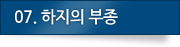 06. 하지의 부종